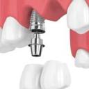 implantdentar.info.ro